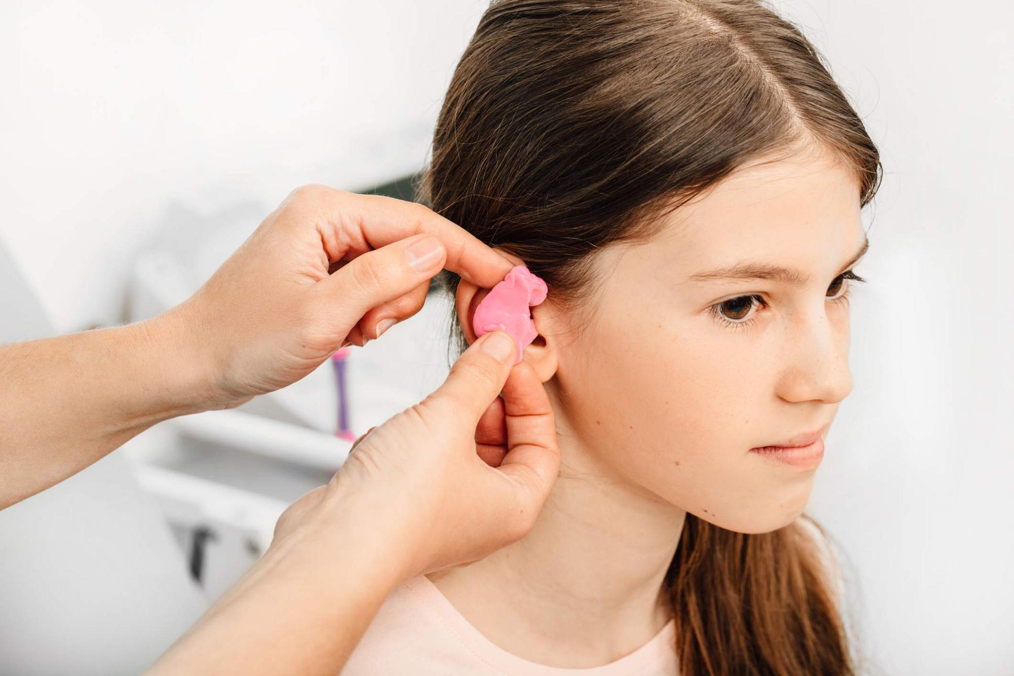 Are Expensive Custom-Molded Earplugs for Hearing Protection Worth the Cost